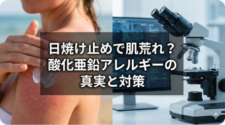 日焼け止めで肌荒れを起こした女性の背中と、科学的な顕微鏡が並ぶアイキャッチ画像。中央に「日焼け止めで肌荒れ？酸化亜鉛アレルギーの真実と対策」というテキストが書かれている。酸化亜鉛アレルギーの科学的解明と正しい選び方を解説する記事。 TITLE: 日焼け止めで肌荒れ？酸化亜鉛アレルギーの真実と対策 FILENAME: sunscreen-zinc-oxide-allergy-truth.png